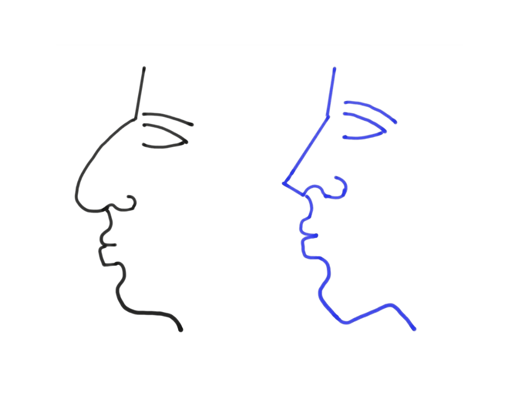 Rhinoplasty (Nose Reshaping)
